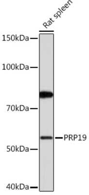 Western Blot: PRP19 Antibody (4M3Z1) [NBP3-16853]