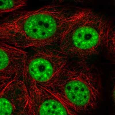 Immunocytochemistry/ Immunofluorescence: PRP19 Antibody [NBP2-38864]