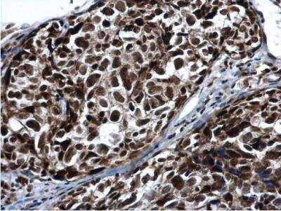 Immunohistochemistry-Paraffin: PRP19 Antibody [NBP1-31354]