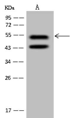 Western Blot: PRP19 Antibody [NBP2-98571]