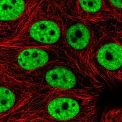 Immunocytochemistry/ Immunofluorescence: PRPF3 Antibody [NBP2-57826]