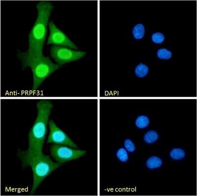Immunocytochemistry/ Immunofluorescence: PRPF31 Antibody [NB100-55409]