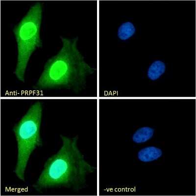 Immunocytochemistry/ Immunofluorescence: PRPF31 Antibody [NB100-55409]