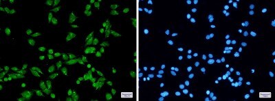 Immunocytochemistry/ Immunofluorescence: PRPF31 Antibody (S01-7F1) [NBP3-19498]