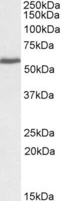 Western Blot: PRPF31 Antibody [NBP1-51909]