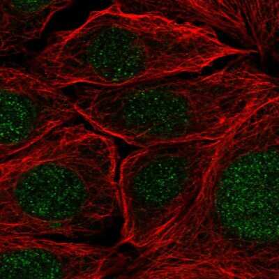 Immunocytochemistry/ Immunofluorescence: PRPF38A Antibody [NBP2-33673]