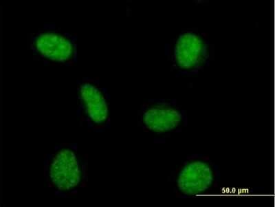 Immunocytochemistry/ Immunofluorescence: PRPF4 Antibody [H00009128-B01P]