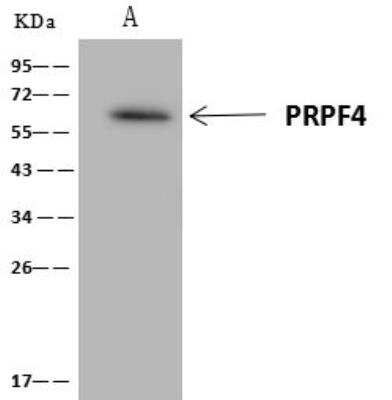 Immunoprecipitation: PRPF4 Antibody [NBP3-12635]