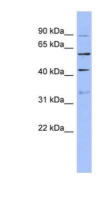 Western Blot: PRPF4 Antibody [NBP1-57150]