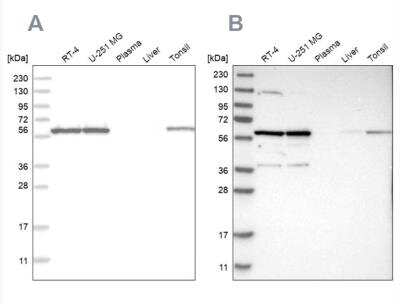 Western Blot: PRPF4 Antibody [NBP1-83218]