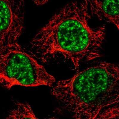 Immunocytochemistry/ Immunofluorescence: PRPF4B Antibody [NBP1-82999]