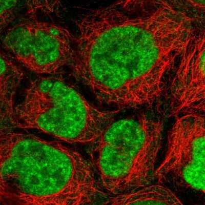 Immunocytochemistry/ Immunofluorescence: PRPF6 Antibody [NBP1-92298]
