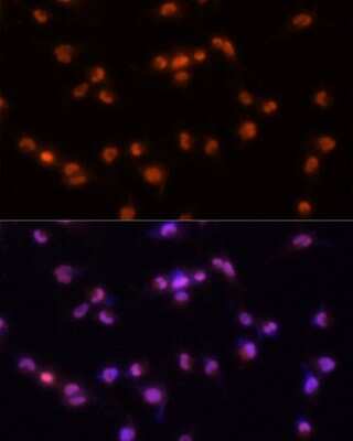 Immunocytochemistry/ Immunofluorescence: PRPF8 Antibody - BSA Free [NBP2-93689]