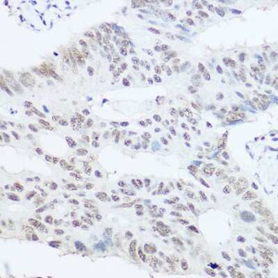 Immunohistochemistry-Paraffin: PRPF8 Antibody - BSA Free [NBP2-93689]