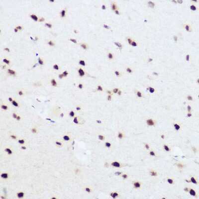 Immunohistochemistry-Paraffin: PRPF8 Antibody - BSA Free [NBP2-93689]