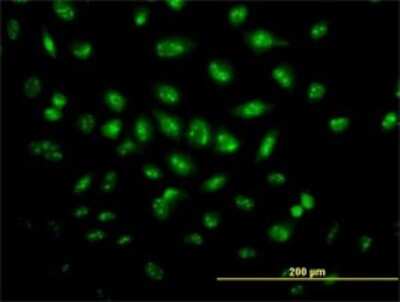 Immunocytochemistry/ Immunofluorescence: PRPK Antibody (2A9) [H00112858-M02]