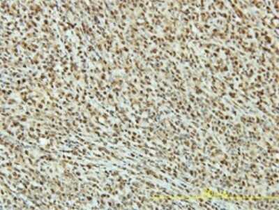 Immunohistochemistry-Paraffin: PRPK Antibody (4B9-1H3) [H00112858-M01]