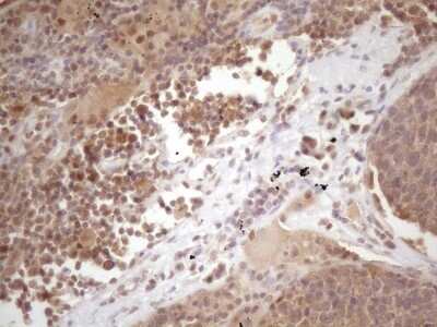 Immunohistochemistry: PRPK Antibody (OTI5B2) [NBP2-46196]