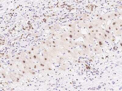 Immunohistochemistry-Paraffin: PRPK Antibody [NBP2-99394]