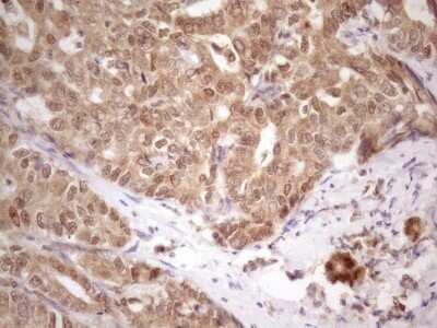 Immunohistochemistry: PRPK Antibody (OTI5B2) - Azide and BSA Free [NBP2-73675]