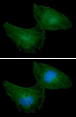 Immunocytochemistry/ Immunofluorescence: PRPS1 Antibody (1E11) - BSA Free [NBP2-42649]