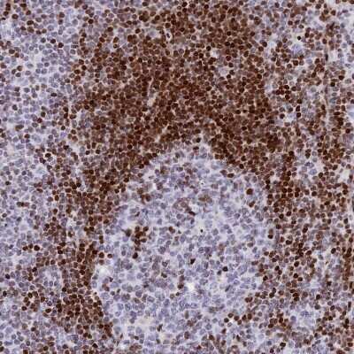 Immunohistochemistry-Paraffin: PRPS1 Antibody [NBP2-13813]