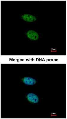 Immunocytochemistry/ Immunofluorescence: PRPS2 Antibody [NBP1-31435]