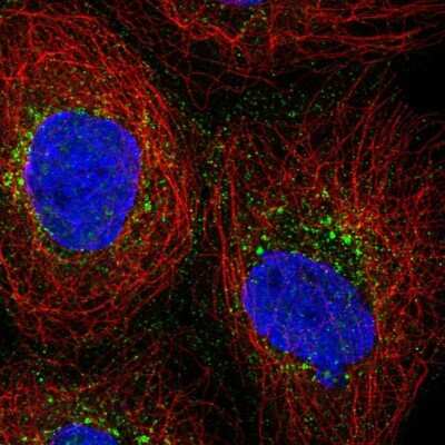 Immunocytochemistry/ Immunofluorescence: PRPS2 Antibody [NBP2-56594]