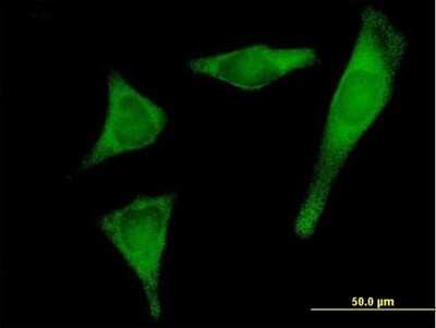 Immunocytochemistry/ Immunofluorescence: PRPSAP2 Antibody [H00005636-B01P]