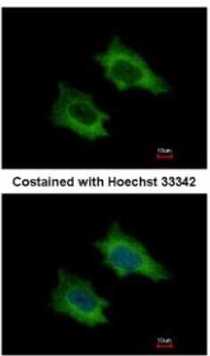 Immunocytochemistry/ Immunofluorescence: PRPSAP2 Antibody [NBP1-32630]
