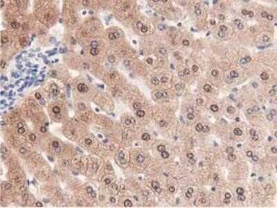 Immunohistochemistry: PRPSAP2 Antibody (OTI1E3) - Azide and BSA Free [NBP2-73676]