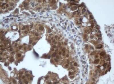 Immunohistochemistry: PRR11 Antibody (OTI2A10) [NBP2-45902]