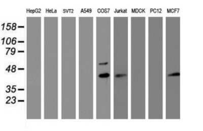 Western Blot: PRR11 Antibody (OTI2A10)Azide and BSA Free [NBP2-73677]