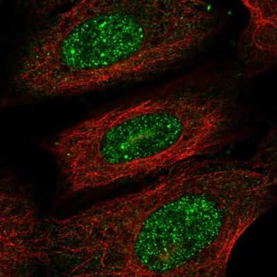 Immunocytochemistry/ Immunofluorescence: PRR13 Antibody [NBP2-55384]