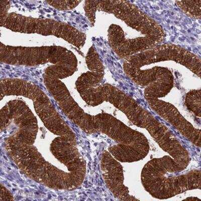 Immunohistochemistry: PRR15 Antibody [NBP2-30799]