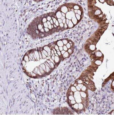 Immunohistochemistry: PRR15 Antibody [NBP2-30947]
