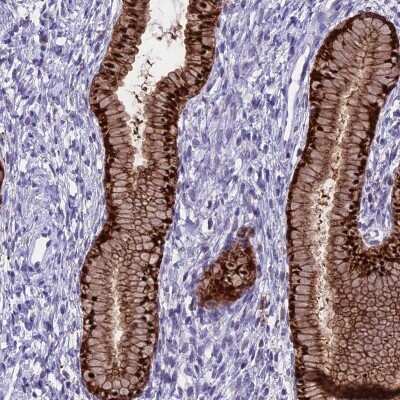 Immunohistochemistry-Paraffin: PRR15 Antibody [NBP2-30799]