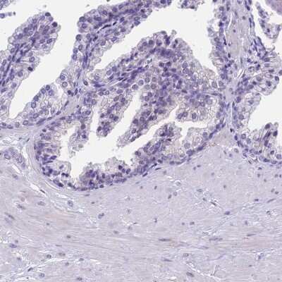 Immunohistochemistry-Paraffin: PRR15 Antibody [NBP2-30799]