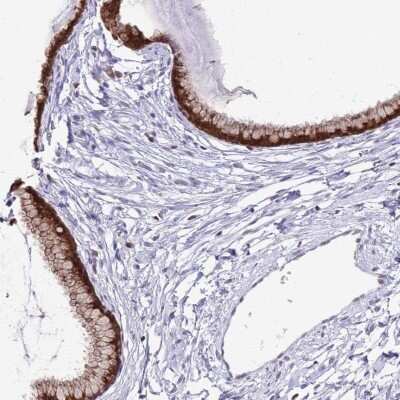 Immunohistochemistry-Paraffin: PRR15 Antibody [NBP2-30947]