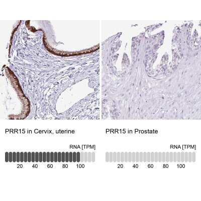 Immunohistochemistry-Paraffin: PRR15 Antibody [NBP2-30947]