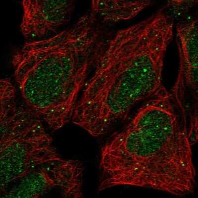 Immunocytochemistry/ Immunofluorescence: PRR22 Antibody [NBP2-47320]
