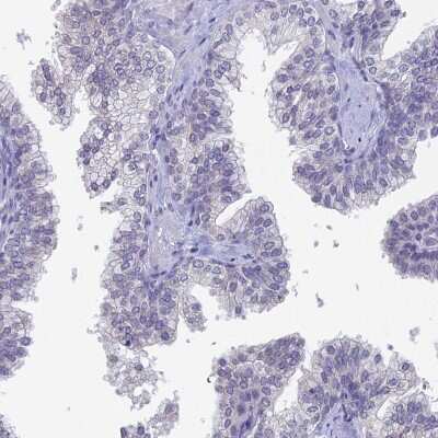 Immunohistochemistry-Paraffin: PRR22 Antibody [NBP2-47320]