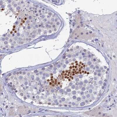 Immunohistochemistry-Paraffin: PRR22 Antibody [NBP2-47320]