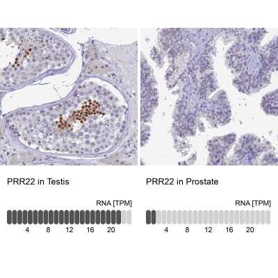 Immunohistochemistry-Paraffin: PRR22 Antibody [NBP2-47320]