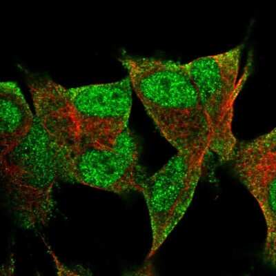 Immunocytochemistry/ Immunofluorescence: PRR3 Antibody [NBP2-55986]