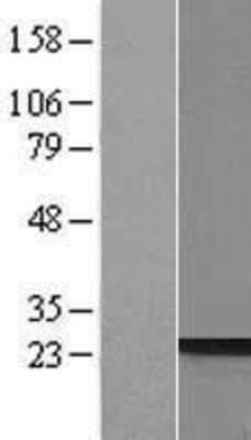 Western Blot: PRR3 Overexpression Lysate [NBP2-06222]