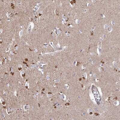 Immunohistochemistry: PRR5 Antibody [NBP2-49114]