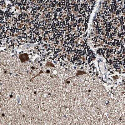 Immunohistochemistry-Paraffin: PRRC2B Antibody [NBP1-90774]