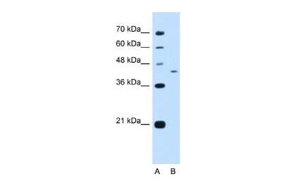 Western Blot: PRRC2B Antibody [NBP2-85540]