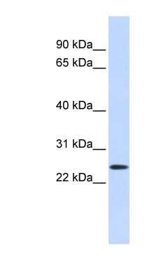 Western Blot: PRRG1 Antibody [NBP1-59907]